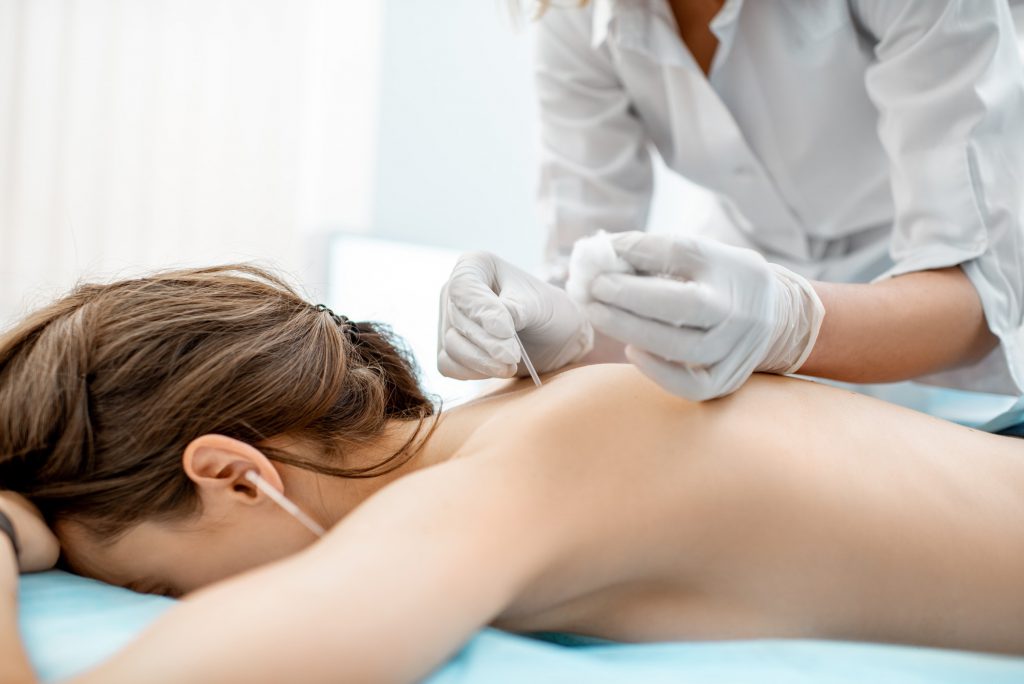 Acupuncture medical treatment