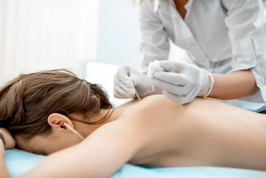 Acupuncture medical treatment